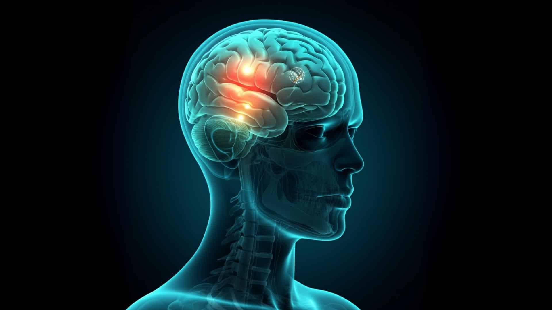 Illustration montrant comment l'hypnose agit sur le cerveau pour arrêter de fumer, avec des zones cérébrales activées et des symboles de méditation et de cigarette barrée.